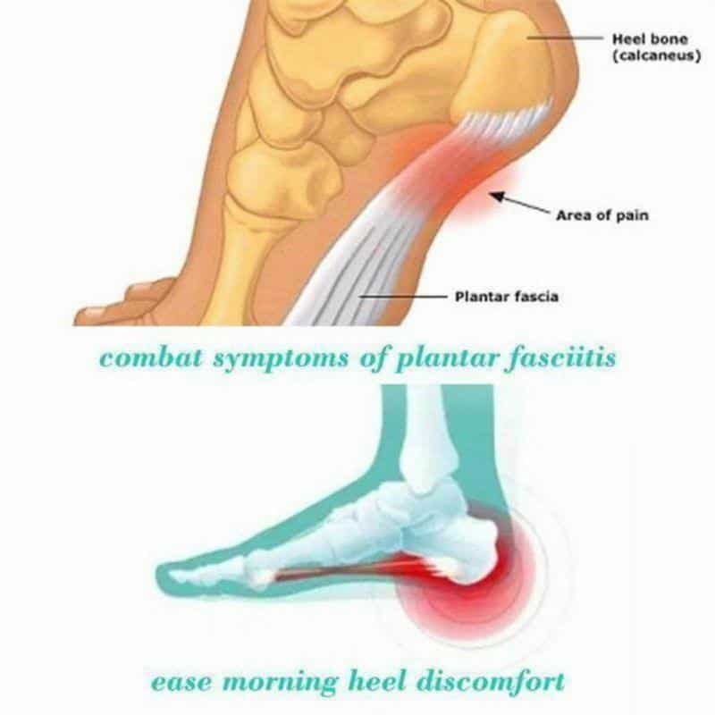 TherapySocks, mágnesterápiás zokni - Image 3